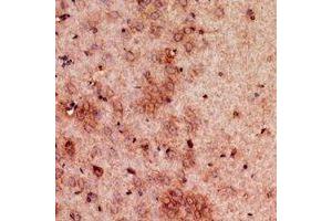 Immunohistochemical analysis of GDI2 staining in mouse brain formalin fixed paraffin embedded tissue section.