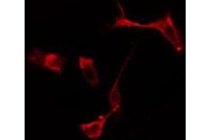 ABIN6275092 staining  Hela cells by IF/ICC. (RFWD2 anticorps  (Internal Region))