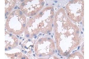 Detection of LIF in Human Kidney Tissue using Polyclonal Antibody to Leukemia Inhibitory Factor (LIF)
