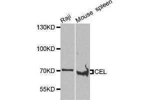 Western blot analysis of extracts of Raji and mouse spleen cells, using CEL antibody.