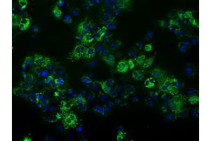 Anti-FAHD2A mouse monoclonal antibody (ABIN2453018) immunofluorescent staining of COS7 cells transiently transfected by pCMV6-ENTRY FAHD2A (RC211128). (FAHD2A anticorps)