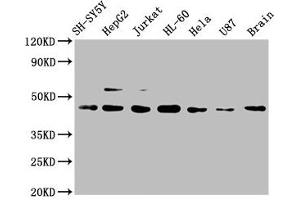 Western Blot Positive WB detected in: SH-SY5Y whole cell lysate, HepG2 whole cell lysate, Jurkat whole cell lysate, HL-60 whole cell lysate, Hela whole cell lysate, U87 whole cell lysate, Mouse brain tissue All lanes: CCR9 antibody at 1 μg/mL Secondary Goat polyclonal to rabbit IgG at 1/50000 dilution Predicted band size: 43, 41 KDa Observed band size: 43 KDa