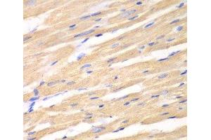Immunohistochemistry of paraffin-embedded Rat heart using DKK3 Polyclonal Antibody at dilution of 1:100 (40x lens). (DKK3 anticorps)