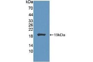 Detection of Recombinant CA7, Mouse using Polyclonal Antibody to Carbonic Anhydrase VII (CA7) (CA7 anticorps  (AA 58-217))