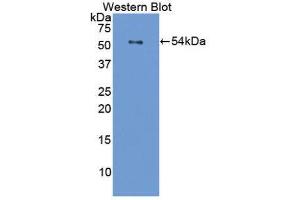 Western Blotting (WB) image for anti-Filaggrin (FLG) (AA 119-336) antibody (ABIN1858899) (Filaggrin anticorps  (AA 119-336))