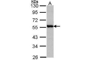 WB Image Sample (30 ug of whole cell lysate) A: A431 , 10% SDS PAGE antibody diluted at 1:1000 (DOK3 anticorps  (C-Term))