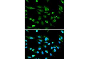 Immunofluorescence analysis of A549 cells using AIRE antibody (ABIN5970888).