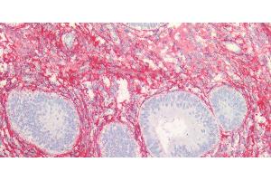 Immunohistochemistry of paraffin-embedded Human endometrium and prostate using COL3A1 Polyclonal Antibody at dilution of 1:100. (COL3A1 anticorps)