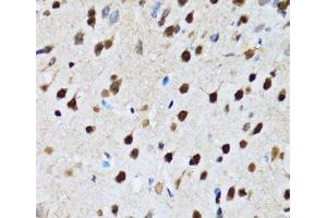 Immunohistochemistry of paraffin-embedded Rat brain using CCAR2 Polyclonal Antibody at dilution of 1:100 (40x lens). (CCAR2 anticorps)