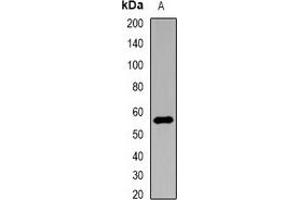 Western blot analysis of Nyctalopin expression in HEK293T (A) whole cell lysates. (Nyctalopin anticorps)