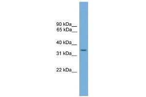 WB Suggested Anti-SLC35A4 Antibody Titration:  0. (SLC35A4 anticorps  (Middle Region))