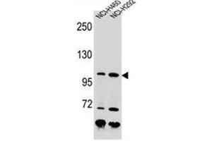 Western blot analysis of Nibrin Antibody (C-term) in NCI-H460, NCI-H292 cell line lysates (35ug/lane). (Nibrin anticorps  (C-Term))