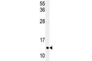 Western blot analysis of LC3C antibody and HeLa lysate (LC3C anticorps  (AA 27-57))