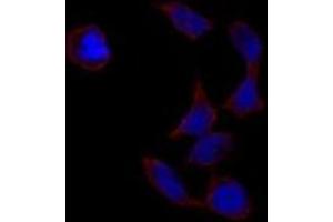 Image no. 2 for anti-POU Class 5 Homeobox 1 (POU5F1) antibody (ABIN357429) (OCT4 anticorps)