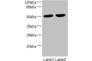 Western blot All lanes: CHRNA10 antibody at 0. (CHRNA1 anticorps  (AA 25-240))