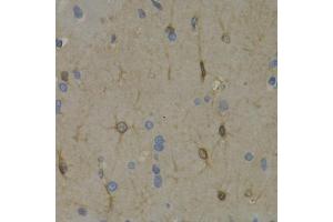 Immunohistochemistry of paraffin-embedded rat brain using WNT3A antibody (ABIN6292349) at dilution of 1:200 (40x lens).