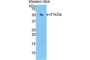 Detection of Recombinant CPT1A, Mouse using Polyclonal Antibody to Carnitine Palmitoyltransferase 1A, Liver (CPT1A) (CPT1A anticorps  (AA 568-773))