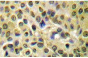 Image no. 1 for anti-V-Akt Murine Thymoma Viral Oncogene Homolog 1 (AKT1) (pSer473) antibody (ABIN317955) (AKT1 anticorps  (pSer473))