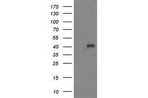 Western Blotting (WB) image for anti-Alcohol Dehydrogenase 1B (Class I), beta Polypeptide (ADH1B) antibody (ABIN1496478)