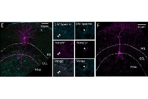Confocal image stacks of representative Axo-axonic cells (AAC) (E) and Basket Cells (F). (SPTBN4 anticorps  (C-Term))