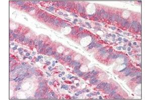 Immunohistochemistry (IHC) image for anti-Cofilin 1 (CFL1) (AA 1-166), (N-Term) antibody (ABIN336102) (Cofilin anticorps  (N-Term))