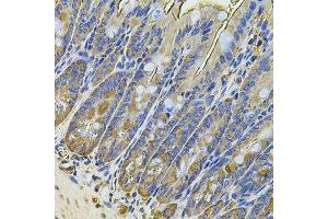 Immunohistochemistry of paraffin-embedded mouse intestine using NAA50 Antibody. (NAA50 anticorps  (AA 1-169))