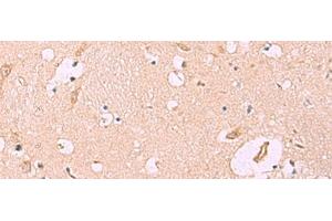 Immunohistochemistry of paraffin-embedded Human brain tissue using MKS1 Polyclonal Antibody at dilution of 1:50(x200)