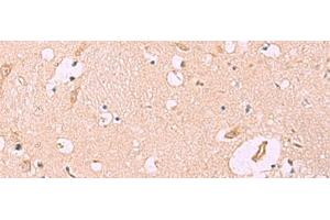 Immunohistochemistry of paraffin-embedded Human brain tissue using MKS1 Polyclonal Antibody at dilution of 1:50(x200) (MKS1 anticorps)