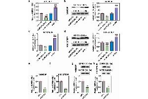 MiR-874-3p downregulation eliminated the effects of LINC00922 silencing on GDPD5 in DDP-resistant GC cells, the expression of which was also decreased via transfection.