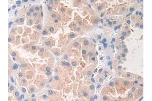 Detection of DOK3 in Human Kidney Tissue using Polyclonal Antibody to Docking Protein 3 (DOK3)