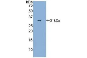 Detection of Recombinant LAB7-2, Human using Polyclonal Antibody to Cluster Of Differentiation 86 (CD86) (CD86 anticorps  (AA 46-282))