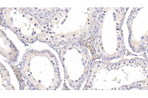Detection of IGFBP1 in Bovine Testis Tissue using Polyclonal Antibody to Insulin Like Growth Factor Binding Protein 1 (IGFBP1)