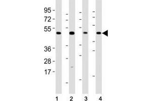 Western blot testing of Mlkl antibody at 1:2000 dilution and mouse samples: (1) lung, (2) NIH3T3, (3) liver, (4) testis lysate; Predicted size: 54 kDa.
