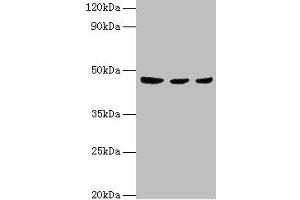 Western blot All lanes: ENTPD5 antibody at 4 μg/mL Lane 1: Mouse liver tissue Lane 2: Mouse kidney tissue Lane 3: Mouse gonad tissue Secondary Goat polyclonal to rabbit IgG at 1/10000 dilution Predicted band size: 48 kDa Observed band size: 48 kDa (ENTPD5 anticorps  (AA 149-428))