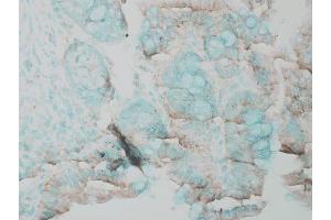Immunohistochemistry analysis using Rabbit Anti-ERK1 Polyclonal Antibody .