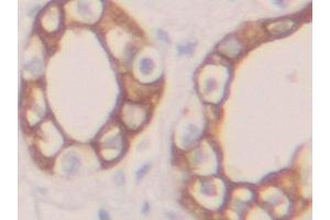 Detection of CK19 in Human Kidney Tissue using Polyclonal Antibody to Cytokeratin 19 (CK19) (Cytokeratin 19 anticorps  (AA 245-391))