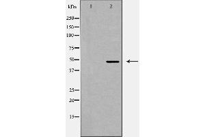 Western blot analysis of GPR103 expression in LOVO cells. (QRFPR anticorps  (Internal Region))