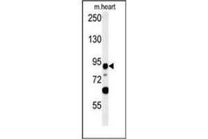 Western blot analysis of LRRC36 Antibody (N-term) in mouse heart tissue lysates (35ug/lane). (LRRC36 anticorps  (N-Term))