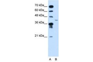 Image no. 1 for anti-Microfibrillar-Associated Protein 3-Like (MFAP3L) (AA 104-153) antibody (ABIN205052) (MFAP3L anticorps  (AA 104-153))