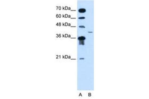 MFAP3L anticorps  (AA 104-153)