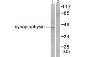 Western blot analysis of extracts from LOVO cells, using Synaptophysin Antibody. (Synaptophysin anticorps  (AA 101-150))