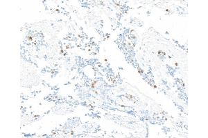Immunohistochemistry (IHC) image for anti-Cyclin A2 (CCNA2) (C-Term) antibody (ABIN7795811)