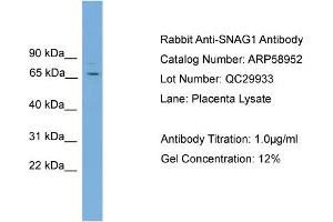 WB Suggested Anti-SNAG1  Antibody Titration: 0. (SNX18 anticorps  (C-Term))