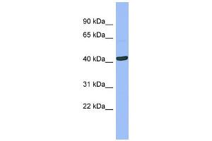 WB Suggested Anti-SERPINB13  Antibody Titration: 0.