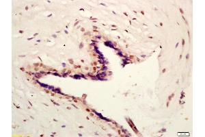 Formalin-fixed and paraffin embedded human placenta labeled with Anti-HSD11B1 Polyclonal Antibody, Unconjugated (ABIN750913) at 1:200 followed by conjugation to the secondary antibody and DAB staining