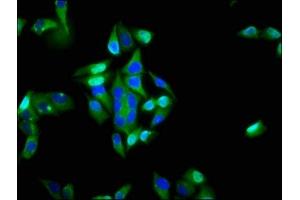 Immunofluorescence staining of Hela cells with ABIN7156446 at 1:200, counter-stained with DAPI. (ITGA6 anticorps  (AA 625-866))