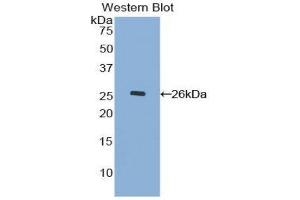 Western Blotting (WB) image for anti-Mucin 17, Cell Surface Associated (MUC17) (AA 3773-3998) antibody (ABIN1078335) (MUC17 anticorps  (AA 3773-3998))