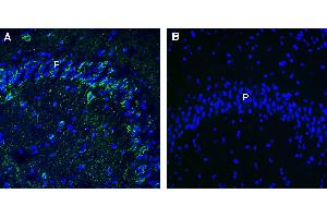Expression of Leptin Receptor in mouse hippocampus. (Leptin Receptor anticorps  (Extracellular))