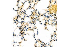 Immunohistochemistry of paraffin embedded mouse lung using MHC-II (ABIN7074245) at dilution of 1:1800 (400x lens)