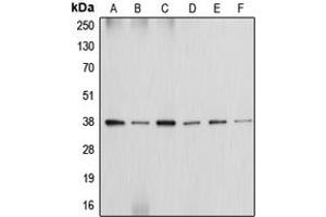 Western blot analysis of Annexin A2 expression in HeLa (A), MCF7 (B), Raw264. (Annexin A2 anticorps  (Center))